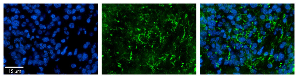 2 - ZDHHC17 antibody - middle region AI12748