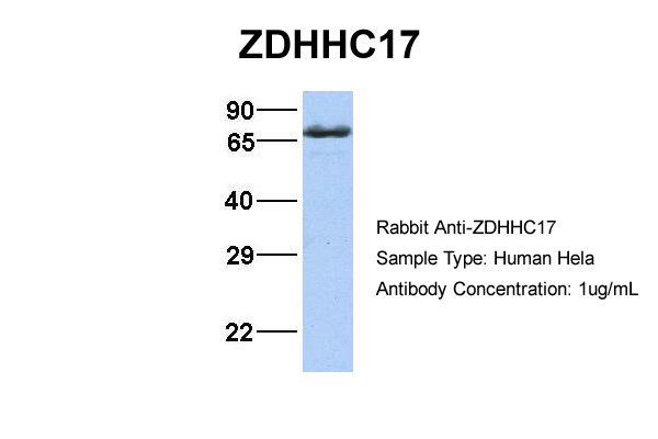 1 - ZDHHC17 antibody - middle region AI12748