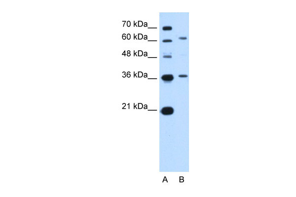 1 - ZSCAN12 antibody - N-terminal region AI12806