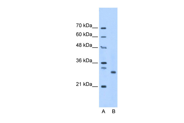 1 - PSMC3IP antibody - middle region AI12819