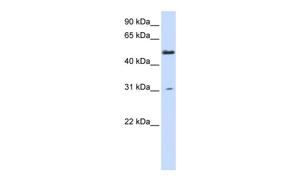 1 - AGXT2L2 antibody - N-terminal region AI12838
