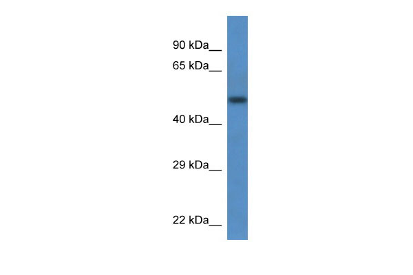 1 - Tcn2 antibody - N-terminal region AI12881