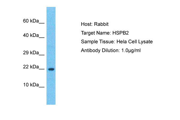 1 - HSPB2 Antibody - N-terminal region AI12884