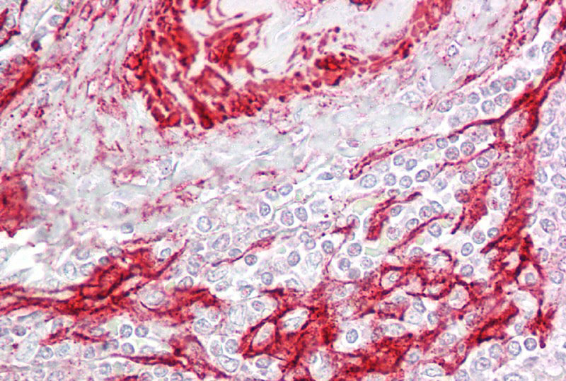 2 - Tagln antibody - C-terminal region AI12892