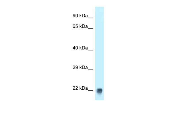 1 - Tagln antibody - C-terminal region AI12892