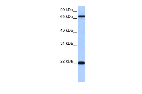 1 - ACCSL antibody - N-terminal region AI12914