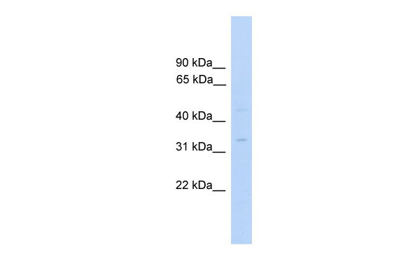 1 - MTFMT antibody - C-terminal region AI12974