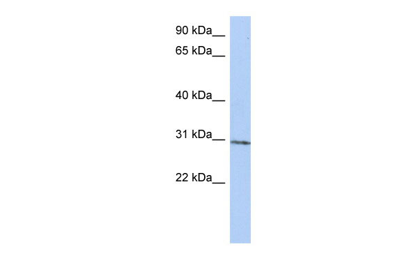 1 - C14orf172 antibody - N-terminal region AI12977
