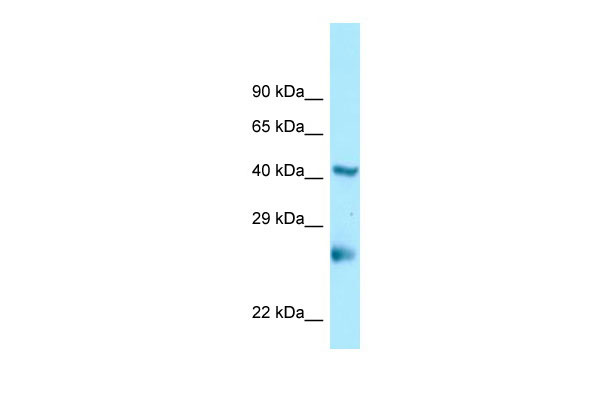 1 - LOC641515 antibody - N-terminal region AI13002