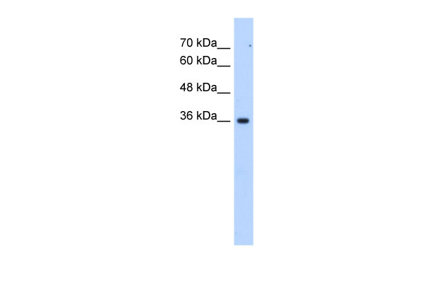 1 - LOC339879 antibody - C-terminal region AI13004