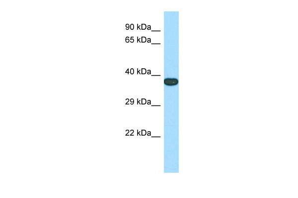 1 - Tmem165 Antibody - N-terminal region AI13014