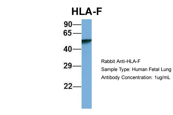 1 - HLA-F antibody - N-terminal region AI13020
