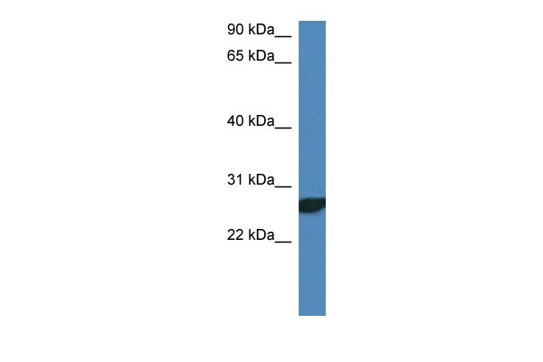 1 - Ndfip2 antibody - N-terminal region AI13025