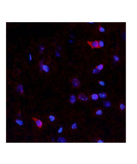 2 - NTN4 antibody - N-terminal region AI13058