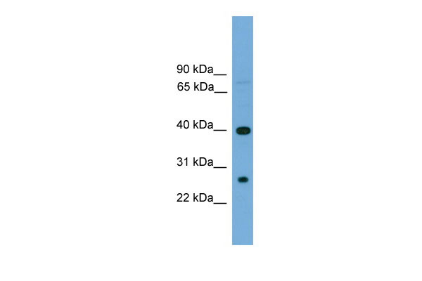 1 - TREML2 antibody - N-terminal region AI13099