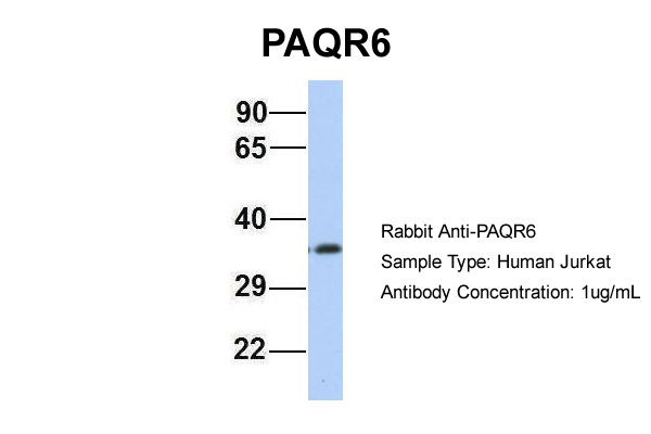 1 - PAQR6 antibody - N-terminal region AI13100