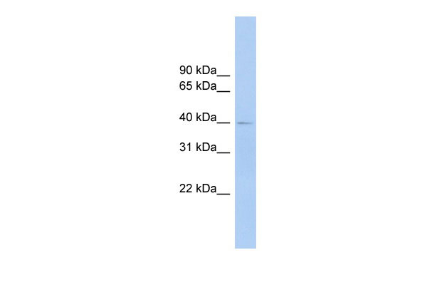 1 - FCRLA antibody - middle region AI13130