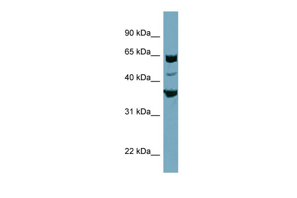 1 - SEC22C antibody - middle region AI13139