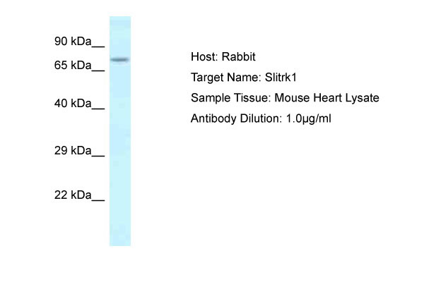 1 - Slitrk1 Antibody - C-terminal region AI13148