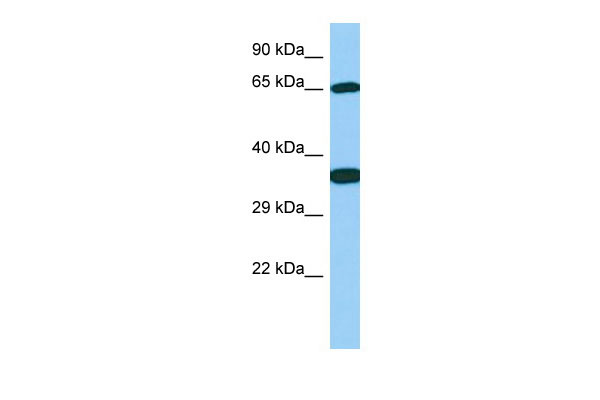 1 - Galnt13 Antibody - C-terminal region AI13149