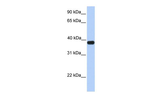 1 - ASB5 antibody - C-terminal region AI13158