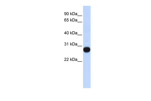 1 - TCEAL4 antibody - middle region AI13161