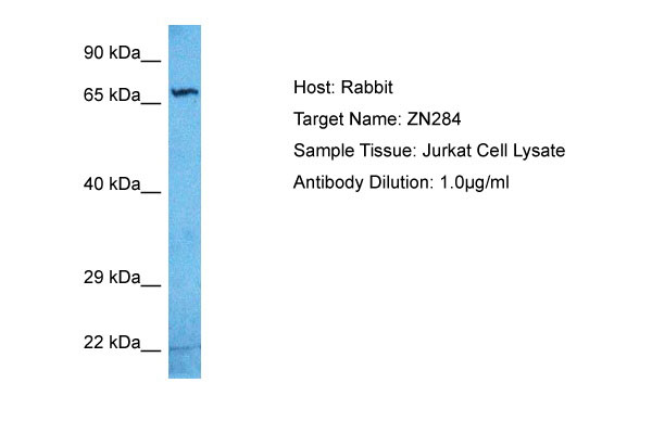 1 - ZN284 Antibody - C-terminal region AI13174