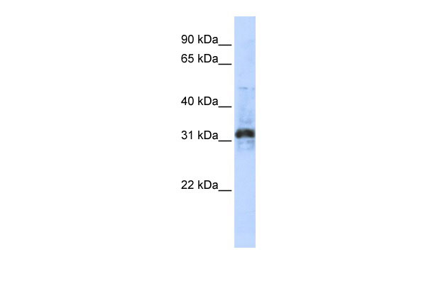 1 - ZNF705D antibody - middle region AI13175