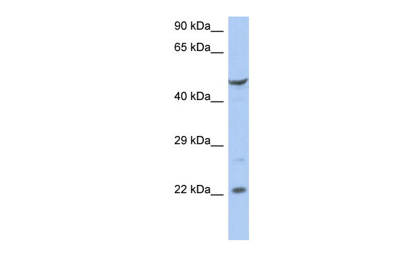 1 - FLJ44894 antibody - N-terminal region AI13176