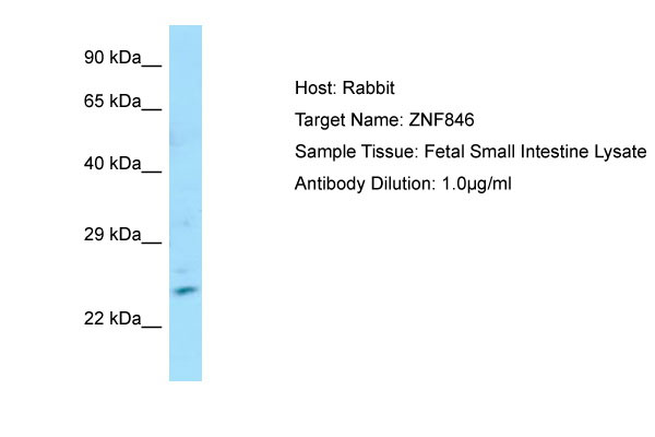 1 - ZNF846 Antibody - N-terminal region AI13178