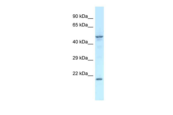 1 - Zfp113 antibody - middle region AI13179