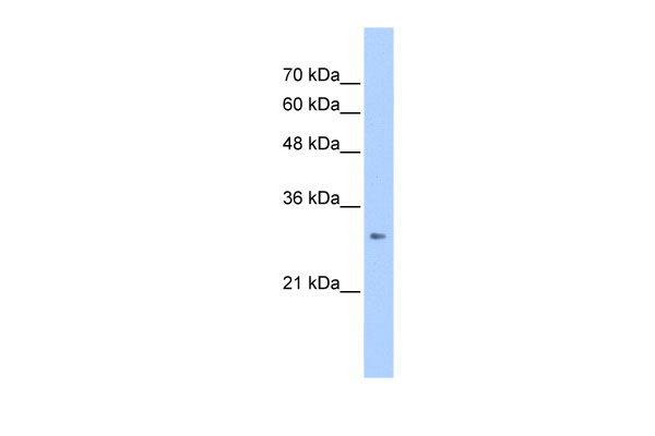 1 - ING1 antibody - C-terminal region AI13184