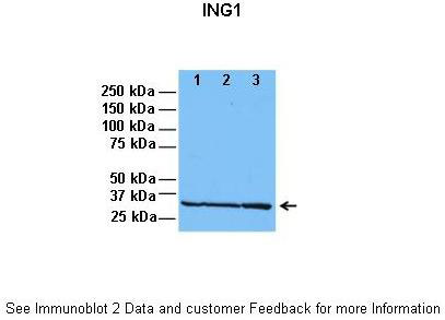 1 - ING1 antibody - C-terminal region AI13184
