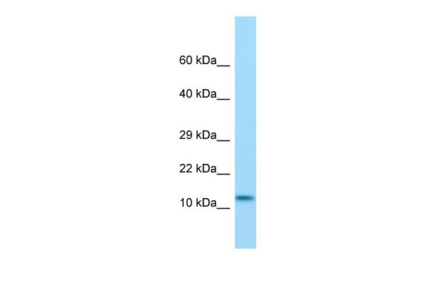 1 - RGD1560833 Antibody - N-terminal region AI13190