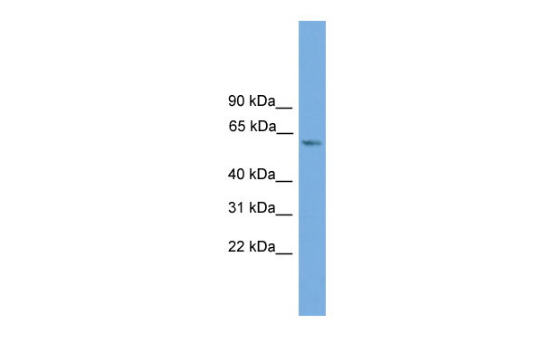 1 - ZBTB46 antibody - middle region AI13204