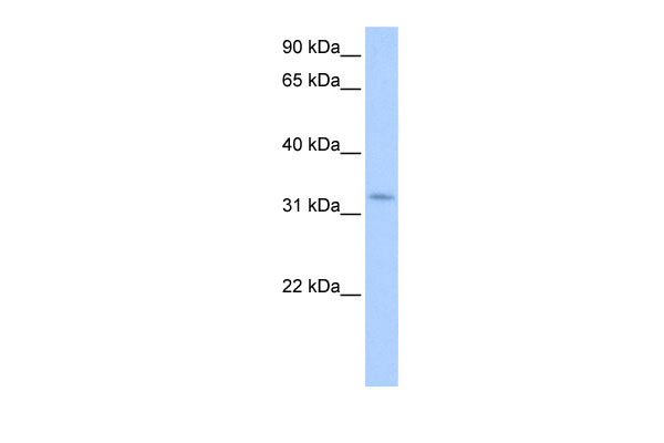 1 - NRIP2 antibody - N-terminal region AI13206