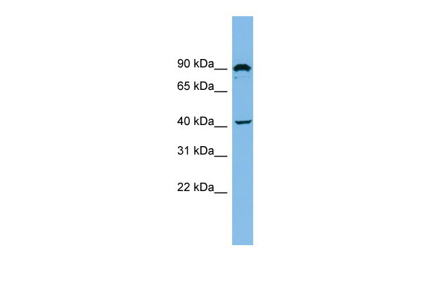 1 - ZMYND12 antibody - N-terminal region AI13207