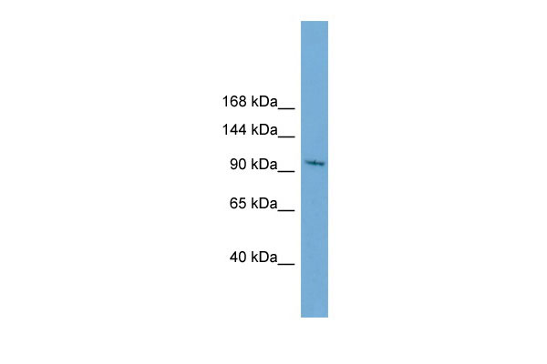 1 - STK31 antibody - N-terminal region AI13212