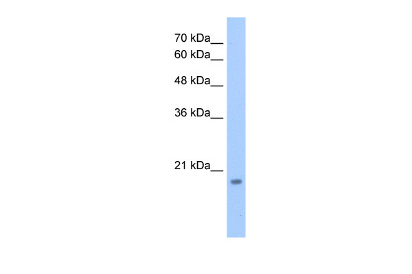 1 - DNTTIP1 antibody - N-terminal region AI13215