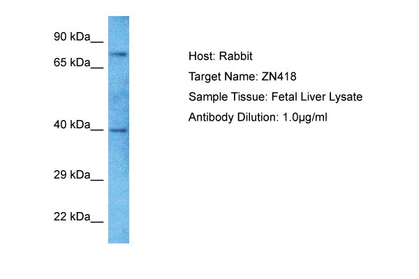 1 - ZN418 Antibody - N-terminal region AI13220