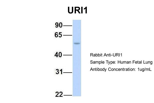 1 - C19orf2 antibody - middle region AI13222