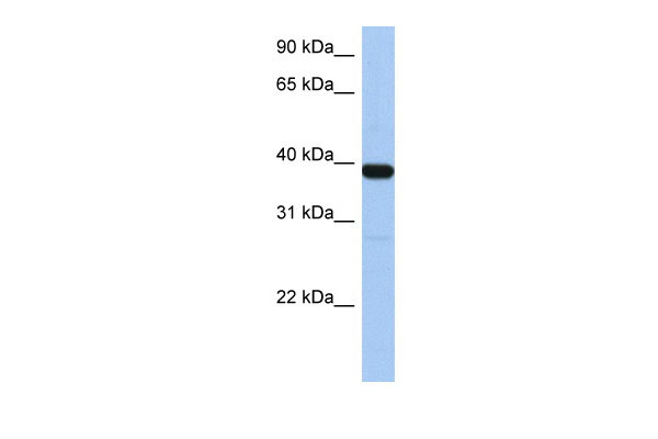 1 - ZNF781 antibody - N-terminal region AI13231