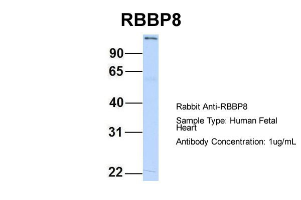 1 - RBBP8 antibody - C-terminal region AI13246