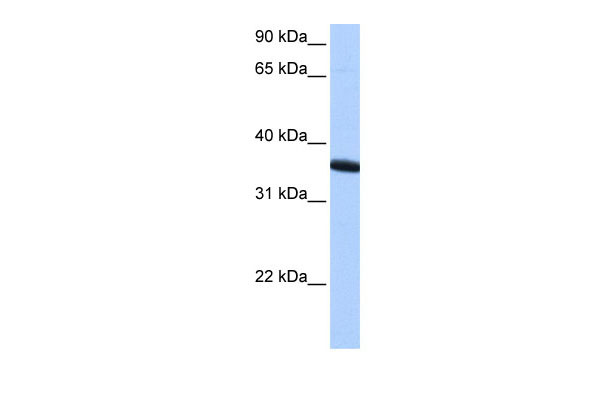 1 - ZNF389 antibody - N-terminal region AI13271