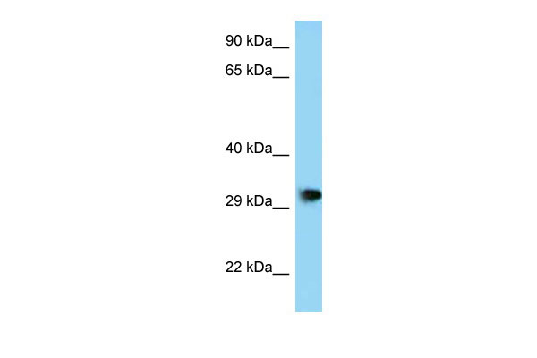 1 - Phf23 antibody - N-terminal region AI13282
