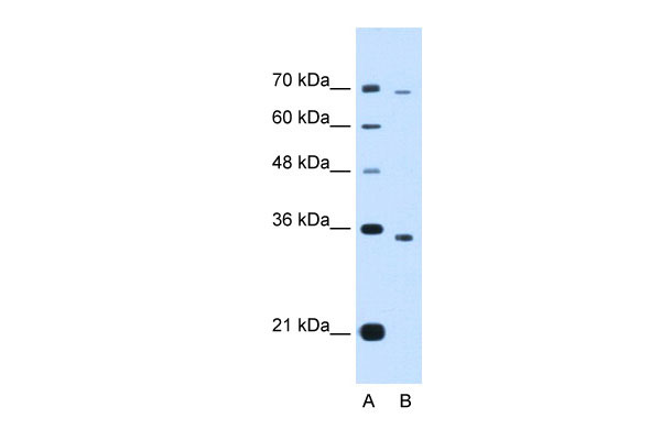 1 - PHF6 antibody - middle region AI13283