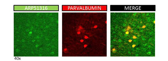 3 - NTRK2 antibody - C-terminal region AI13295