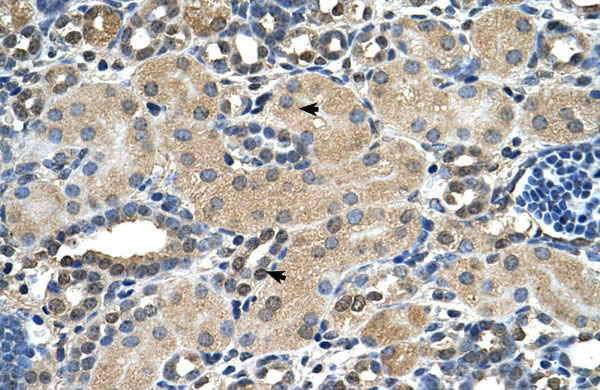 2 - ASPH antibody - N-terminal region AI13301