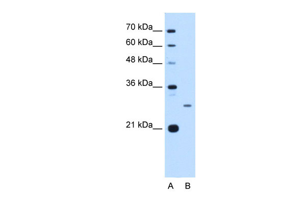 1 - ASPH antibody - N-terminal region AI13301