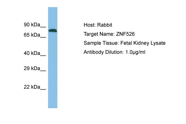 1 - ZNF526 Antibody - N-terminal region AI13312